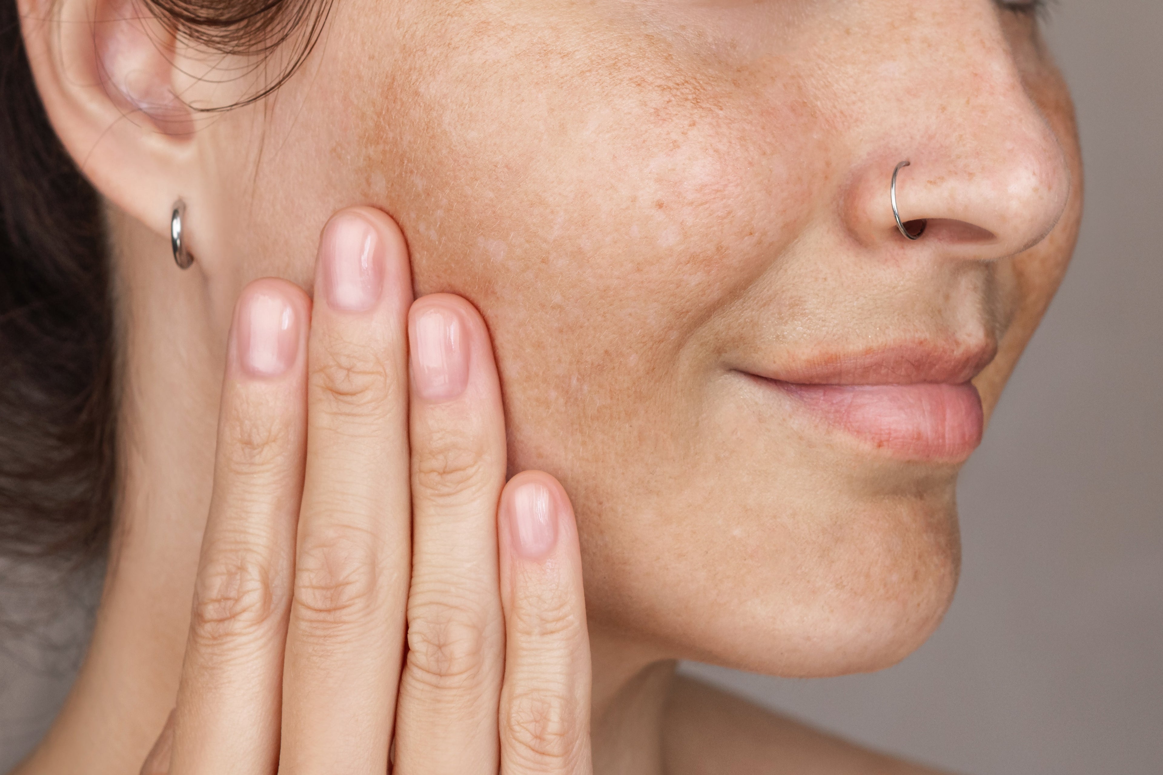 Woman applying sunscreen outdoors in South Florida to protect skin from sun damage and premature aging