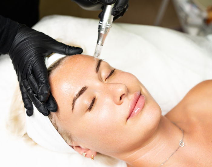 Microneedling in Boca Raton | Boca Skin and Lash